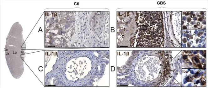 Figure 2. IHC analysis of PMN staining in the placentas at 24-72h post-GBS exposure. 