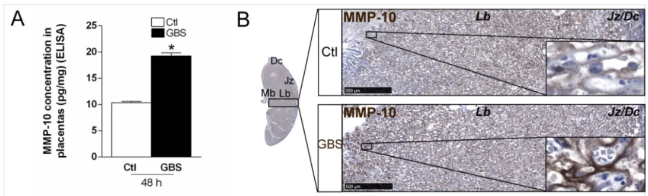 Figure 5. ELISA and IHC analyses of the expression of MMP-10 in the placentas at  48 h post-GBS