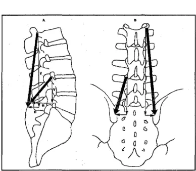 Figure 5 : Les vecteurs de force de la portion lombaire du longissimus thoracique. 