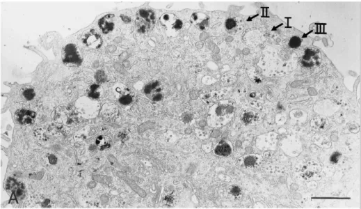 Figure 6 : Morphologie des granules mastocytaires. Visualisation des 3 types de granules  mastocytaires (type I, II et III) par microscopie électronique