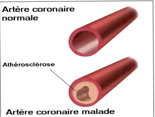 Figure 2  ;  Artère coronaire