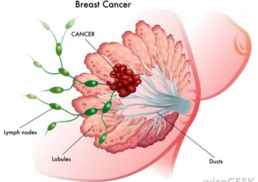 Figure 1. Morphology of the human breast. 1) Lobules are an assembly  of alveolar structures containing specialised cuboidal epithelial cells that  secrete milk