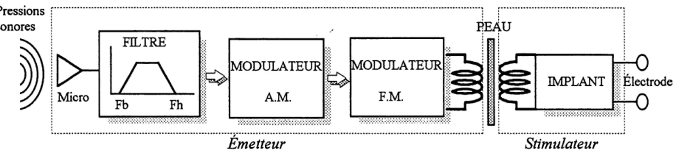 Figure 3.4: Schema d'ensemble du systeme de prothese propose.
