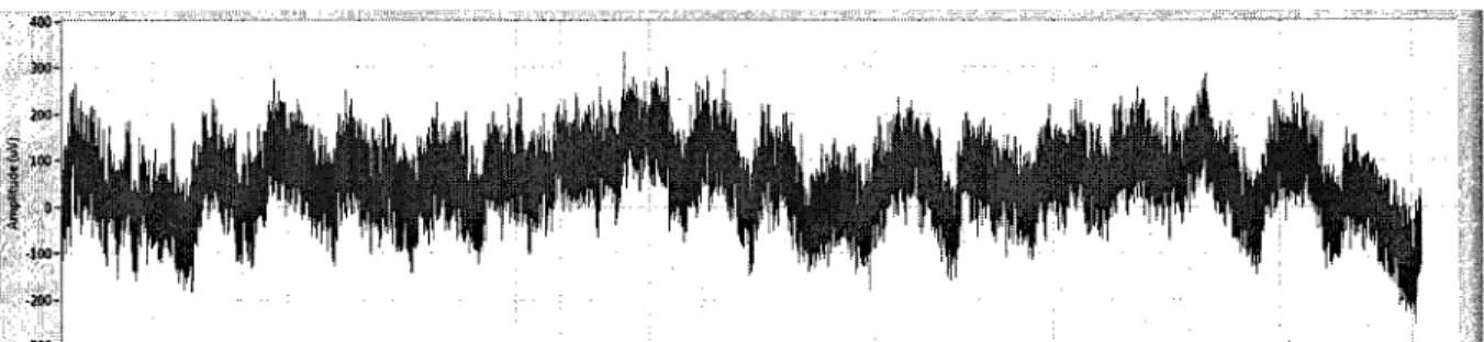 Figure 2.6 : Signal d'electroencephalogramme (electrode T3 : lobe temporal gauche) 