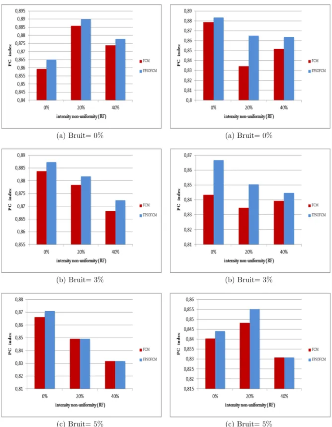 Figure 6.3: Comparaison de l’indice PC sur des images simul´ ees pond´ er´ ees en T1.