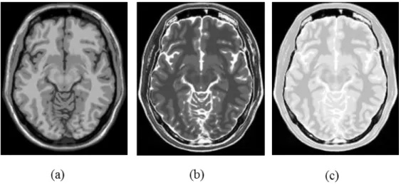 Figure 1.5: Les s´ equences IRM : (a) image pond´ er´ ee en T1, (b) image pond´ er´ ee en T2, (c) image pond´ er´ ee en DP.