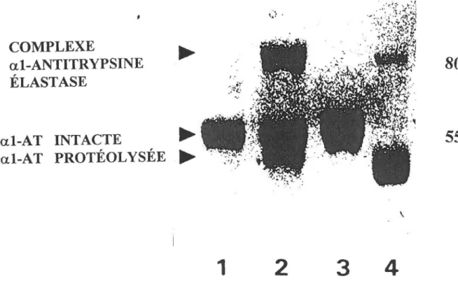 Fig  no  5:  Effet  de  l'élastase  porcine  pancréatique  sur  l'al-antitrypsine  oxydée
