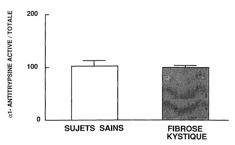 Fig  no 7:  Capacité fonctionnelle inhibitrice de l'a1-AT sérique purifiée des sujets  sains  et des patients  atteints de fibrose  kystique