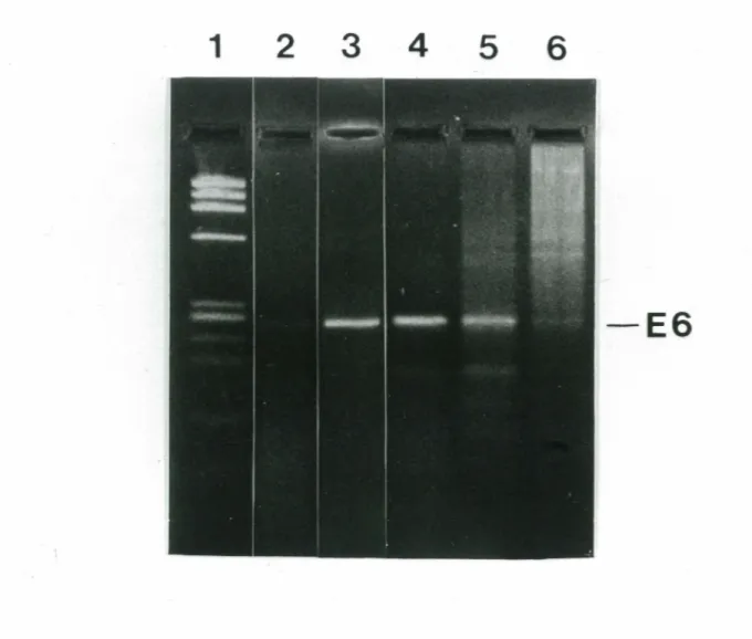 FIGURE 8. Effet des variations de  concentrations en MgCl 2  sur l'efficacité des réactions  PCR