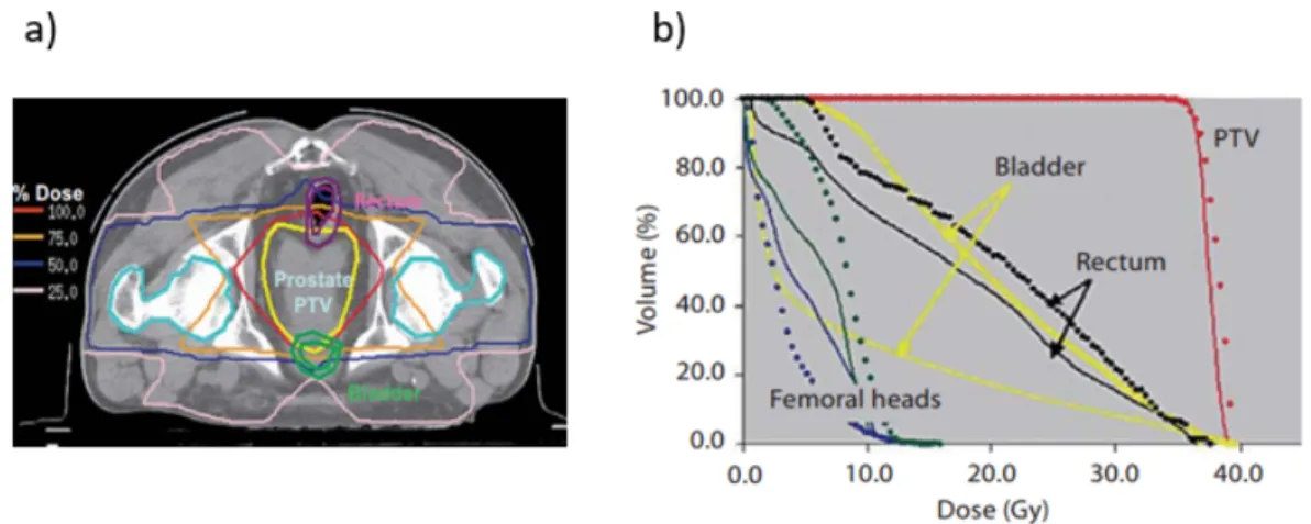 Figure 1.3: Example of treatment plan evaluation for prostate cancer by the verification of the isodose distribution (a) and the dose-volume histograms (b) [19].