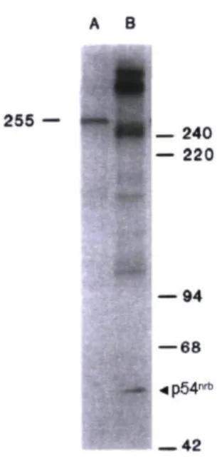 Figure 5. Patron d'immunoréactivité de l'anticorps phosphodépendant CC-3 sur un  extrait de cellules CHO interphasiques (A) et mitotiques (B) (Thibodeau et al., 1989)