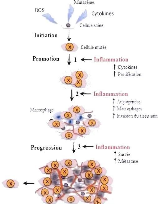 Figure 6 : Contribution de l'inflammation dans la  progression tumorale. 