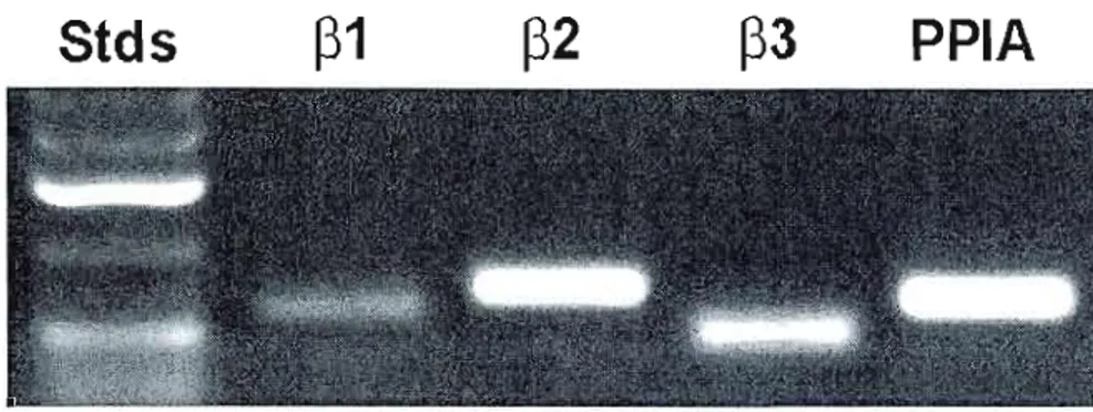 Fig.  1:  Gene  expression  analysis  of  ~-adrencrgic  recertor  expression  in  DAOY  medulloblastoma  cells