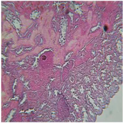 Figure 19: Congestive liver  with architecture preservation of male 