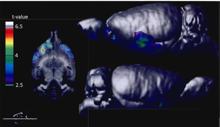 Figure  3:  t-statistical  maps  [non-lesioned  >  NBM  lesioned]  representing  cortical  declines  of the  [18 F]FEüBV  BPND  following  NBM  lesion