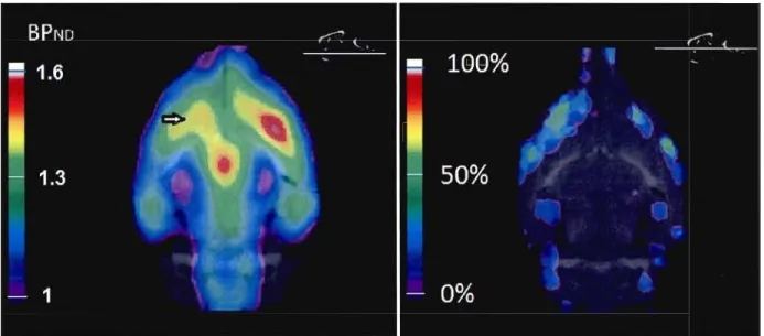 Figure  4:  Distribution  of  [18  F]FEüBV  BP ND  declines  following  lesion  of the  NBM