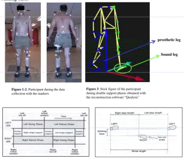 Tableau 1. Mean and standard deviation of the speed of walking, cadence, duration of gait cycle, support and swing phases, length of stride and step, and walking base for four male transfemoral amputees (three trials).