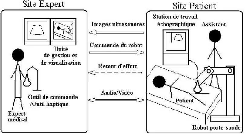 Figure 1.5 : Schématisation du principe d'un système de télé-échographie robotisée  [01]