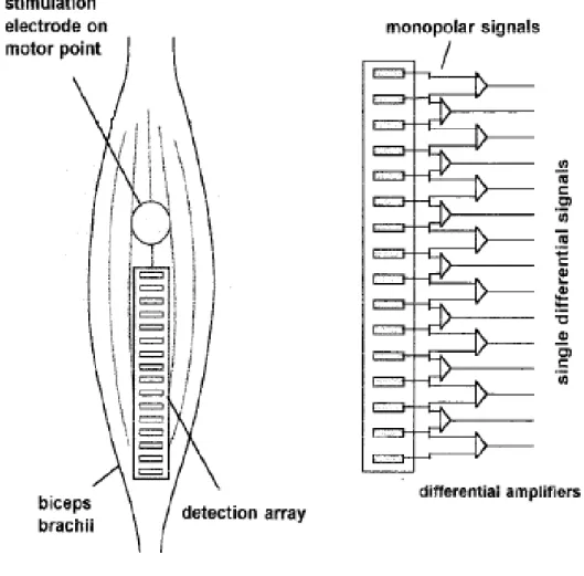 Figure 1.10. Représentation schématique de la modalité de détection à l’aide d’une configuration  constituée de 16 électrodes situées linéairement sur une barrette à la surface du muscle biceps brachial 