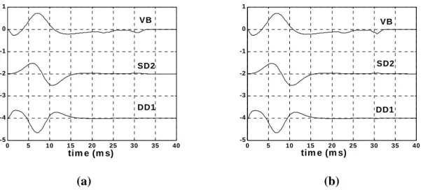 Figure  2.6. Signaux monopolaire SD et signaux bipolaires DD simulés avec les valeurs des paramètres  du modèle
