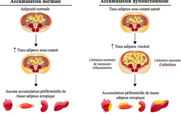 Figure 4 : Processus normal et dysfonctionnel de l’accumulation du tissu adipeux 