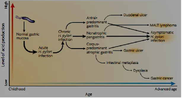 Figure  07:  Natural progression of  H. pylori infection.  Infection usually occurs during childhood and  causes  symptomatic  acute  gastritis