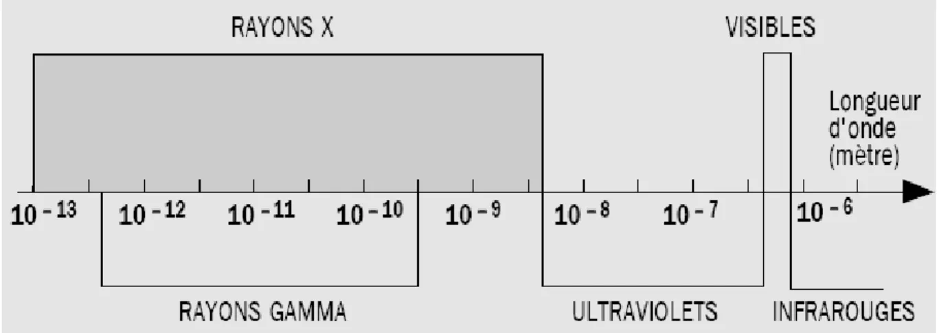 Figure I-4 : Examen par rayons X. 