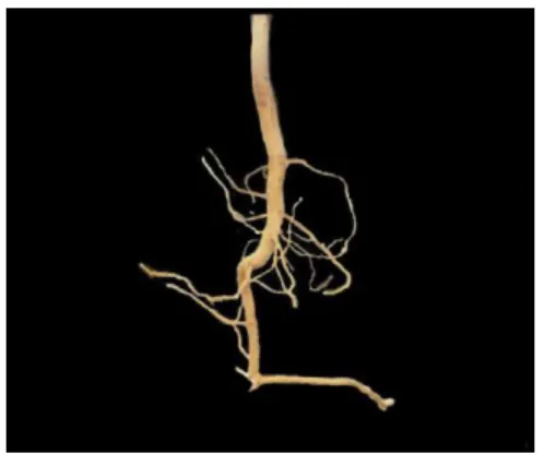 Fig. 2 Racine pivotante déformée par le compactage du sol à des profondeurs multiples (Raper et al., 2006)