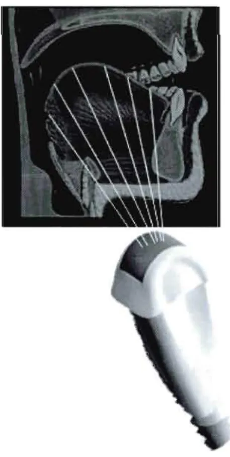 Figure  3.4  Coupe  sagittale  de  la  surface  de  la  langue  telle  que  captée  par l'ultrasonographie