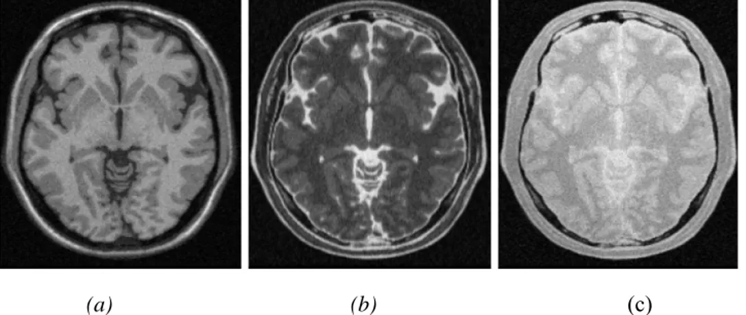 Figure 9: Les Séquences IRM, (a) :  Image pondérée en  ρ  ,(b) :Image pondérée en T 2 