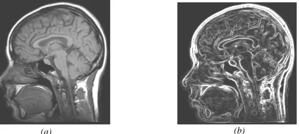 Figure 13 : Segmentation, approche contour. (a) : image IRM  originale, (b :) image  segmentée (approche contour) 