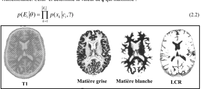 Figure 15 : Segmentation par méthode bayésienne. 