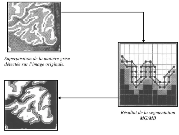Figure 21 : Segmentation coopérative séquentielle de la MB et MG. 