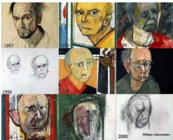 Figure 2 : Évolution des autoportraits réalisés entre les années 1967 et 2000 par le  peintre américain William Utermohlen atteint de la MA