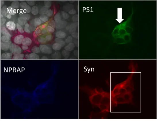 Figure 16 : Immunofluorescence de NPRAP, PS1 et Syn dans des cellules SH-SY5Y.  
