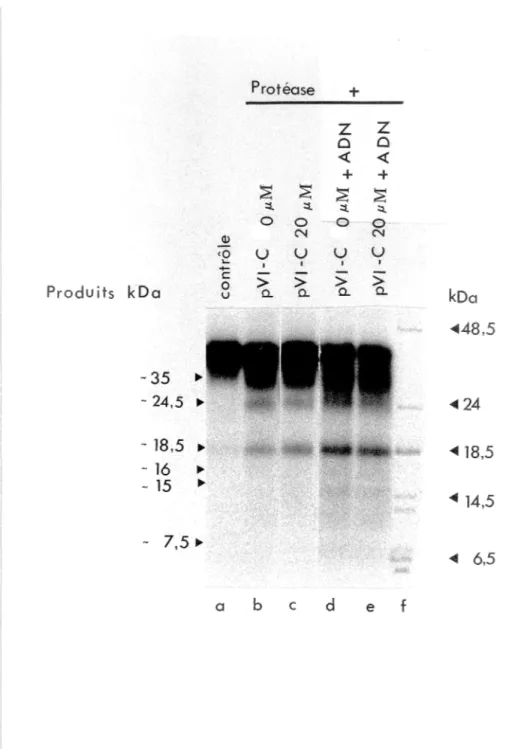 Figure 4: Profil de clivage de l'ovalbumine par la protéase recombinante purifiée en présence de  pVI-C et de  l'ADN