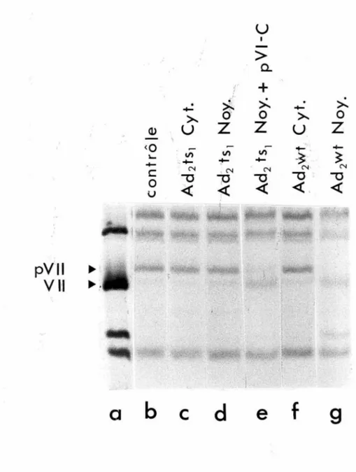 Figure  5:  Essais  in  vitro  impliquant  des  extraits  cytoplasmiques  et  nucléaires  en  présence  du  substrat ts1-[ 35 S]  (Trans)