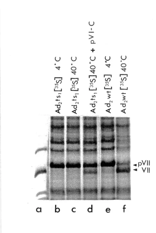 Figure 6: Extraits des noyaux de cellules infectées par ad 2 ts 1  et ad 2 wt.  Les  précurseurs viraux ont  été  marqués  à  la  méthionine-[ 35 S]  in  vitro  (Cis)