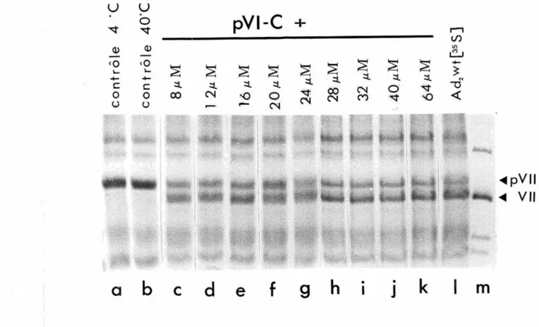 Figure 7: Effet du cofacteur pVI-C sur les extraits des noyaux de cellules infectées par ad 2 ts 1•  Les  précurseurs viraux ont été marqués  à  la  méthionine-[ 35 S]  in  vitro