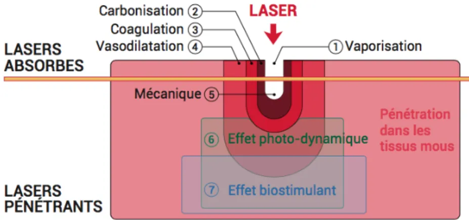 Figure 13. Principaux effets du laser sur les tissus. (Adapté de Rey et coll.(76)) 