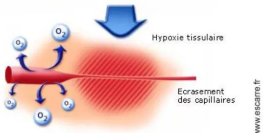 Figure 2 : Hypoxie tissulaire [7] 