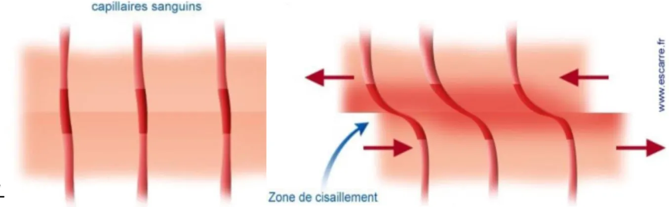 Figure 5 : Forces de cisaillement [10] 