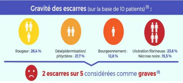 Figure 12 : Pourcentage des escarres selon la gravité [18] 