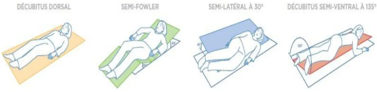 Figure 18 : Les différentes techniques de positionnement sur le lit [29] 
