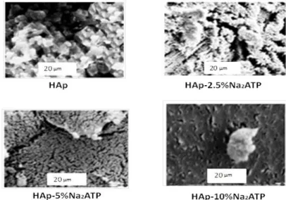 Fig 6: SEM images of HAp (samples dried at 80°C), (scale bar = 20 μm) and Hap-2.5% Na 2 ATP, Hap-5% Na 2 ATP,  Hap-10%Na 2 ATP (scale bar = 20 μm) (dried at 80 °C)