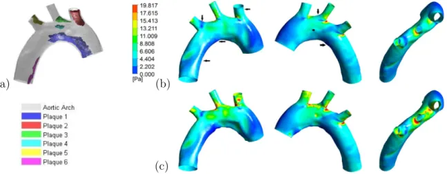Fig. 9. (a) Location of plaques in the aortic arch with the corresponding nomenclature