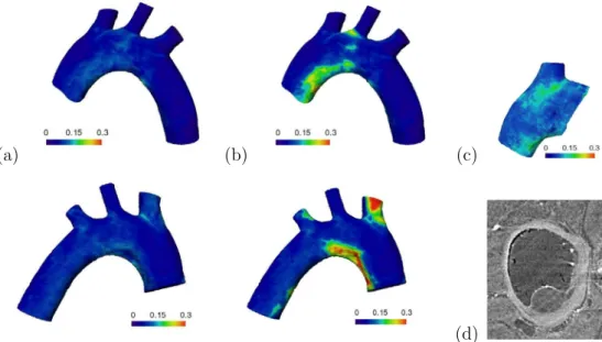Fig. 5. Wall thickness in mm for the: (a) healthy conﬁguration with the plaques numerically removed, (b) diseased conﬁguration taking into account the plaques, (c) ascending aorta and BCA of control mice