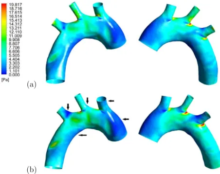 Fig. 7 shows the isocontours of TAWSS for cases A and B. The results are in quantitative and qualitative agreement with previous studies [36,38,39,41,44,50] conducted in mice aortic arches