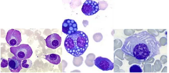 Figure 9 : différents aspects des plasmocytes (coloration MGG x250) (24) 