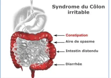 Figure 4 : La localisation de la zone des différents symptômes sur le colon (12) 